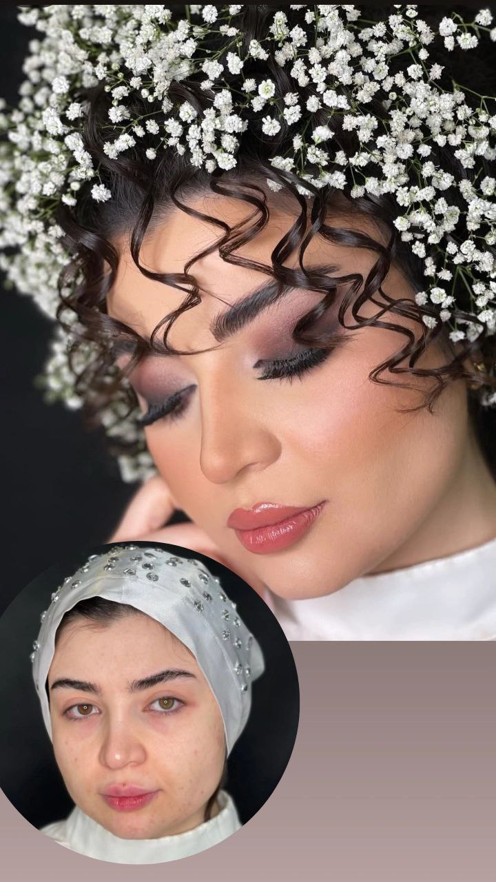 نمونه شینیون