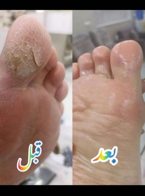 پدیکور پا